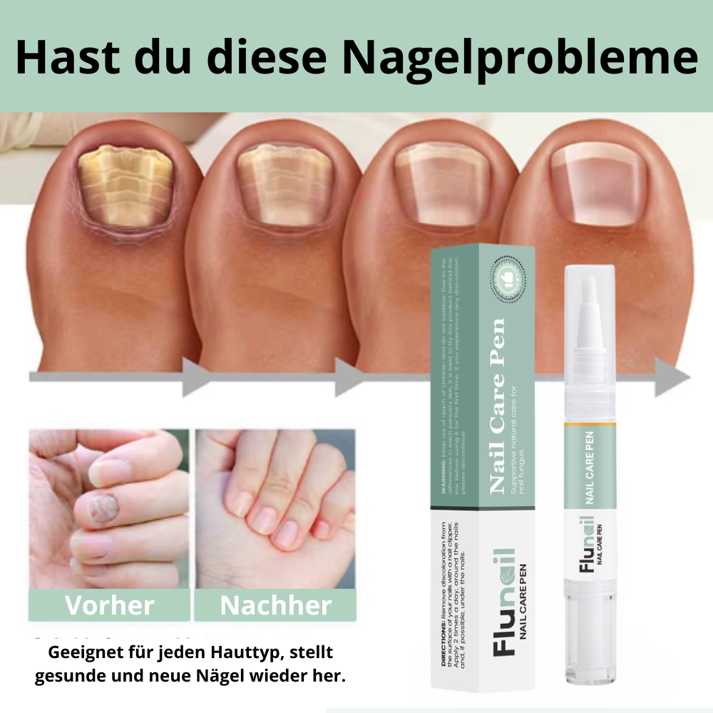Flunail® Nagelpilz Stift – Natürliche Nagelpflege 5g