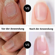 Flunail® Nagelpilz Stift – Natürliche Nagelpflege 5g